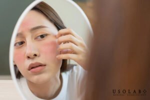 What Is Sensitive Skin? How to Identify and Care for It Effectively | Usolab Philippines