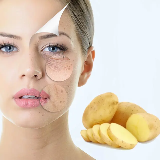 Skincare routine for managing melasma and dark spots at home